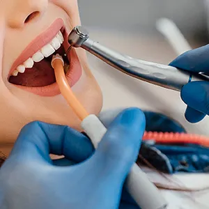Implantes & Rehabilitación